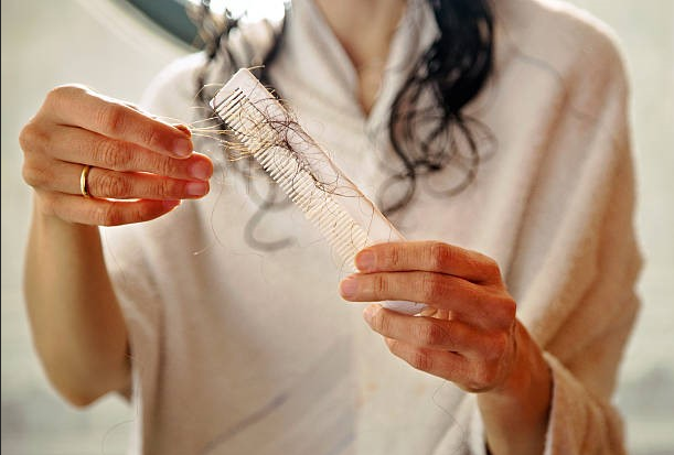 Hair Loss Consultation